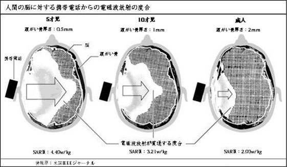 人間の脳に対する携帯電話からの電磁波放射の度合い